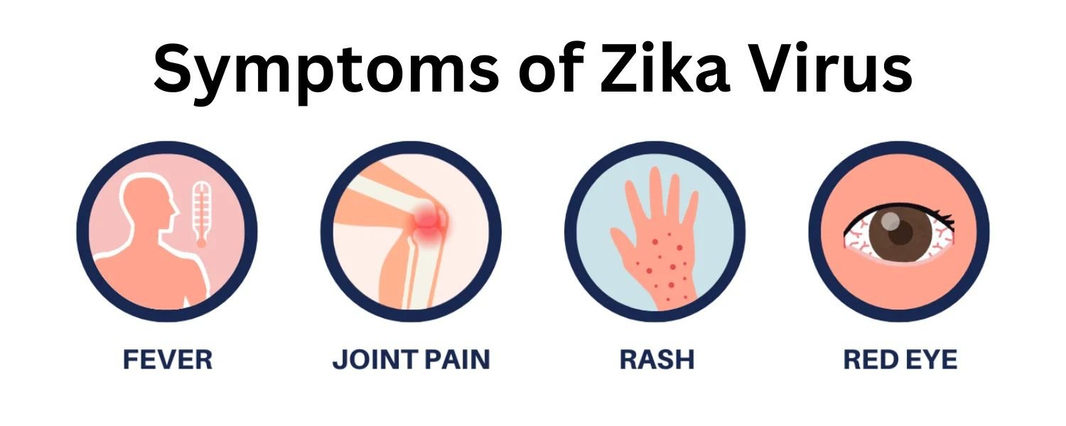 What are the Symptoms of Zika?