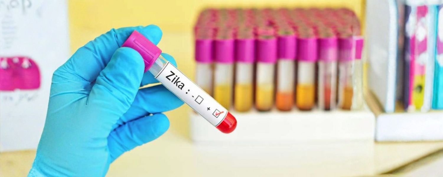 How is Zika Diagnosed