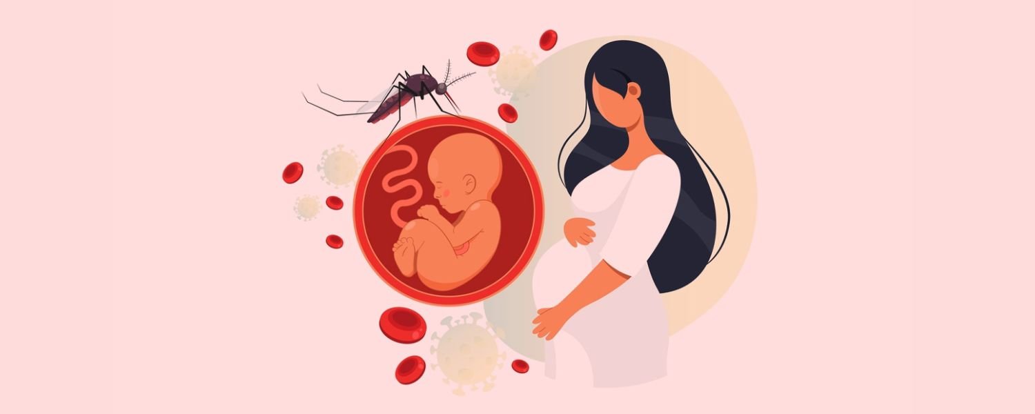What Happens if You’re Pregnant and Get Zika