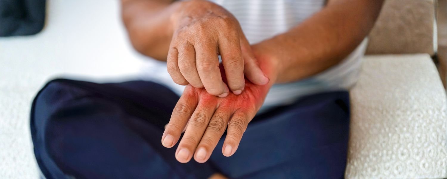 Allergies to Bean Sprouts