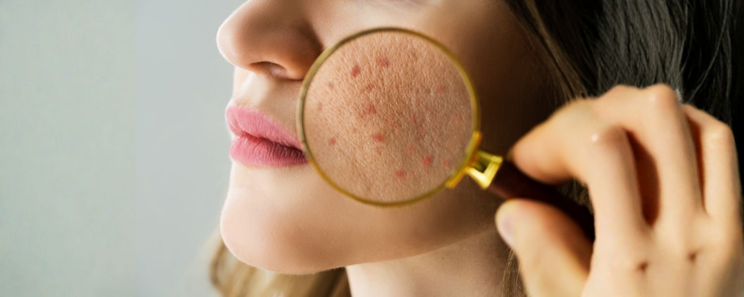 Climate_ Consider your local climate. Lightweight gel moisturizers are ideal in humid climates, while a slightly richer formula might be needed in drier climates