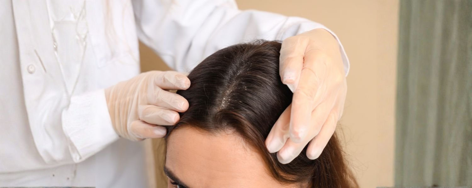Deep Condition for Dandruff-Free Scalp, Monsoon skincare tips