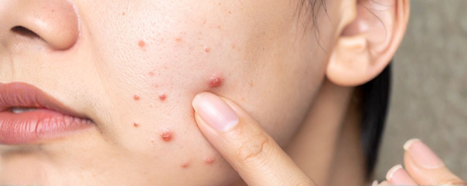 Reduces Inflammation